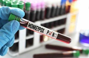 What Does Monkeypox Look Like?